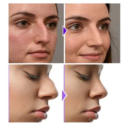 Silicone EMS Nose Shaper – Appearance-Enhancing Facial Sculpting Tool